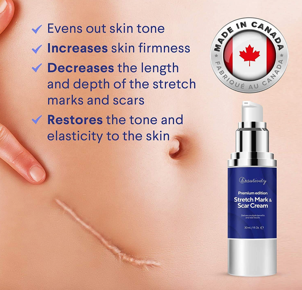 Stretch Mark and Scar Removal Cream